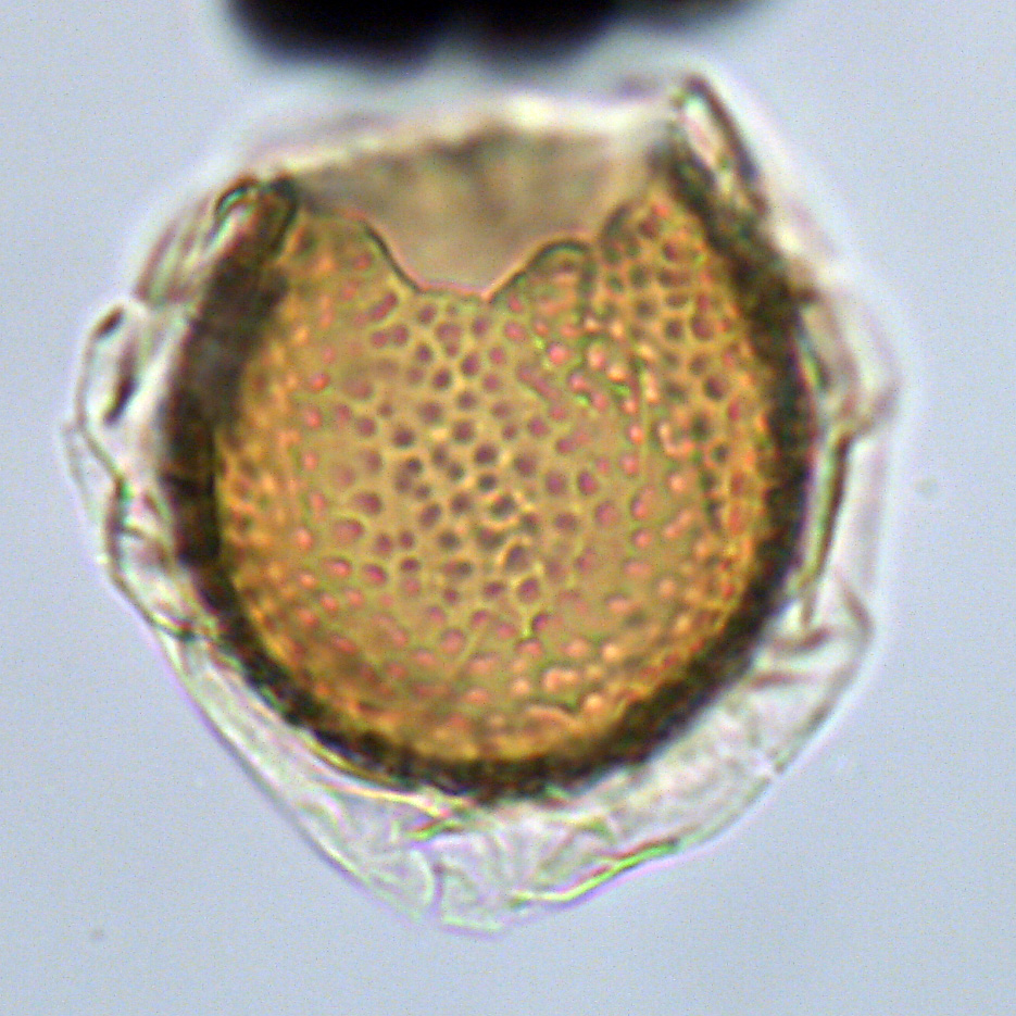 Leberidocysta chlamydata, U1581-28R-6W, 106-110, sl. 1, M35, foto-b.jpg